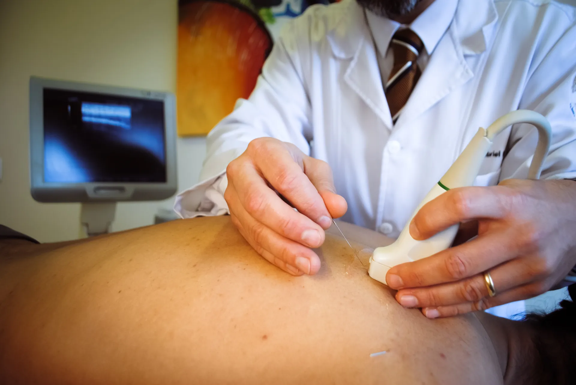 Acupuntura Médica Moderna com Ultrassom